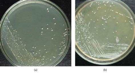 Isolation and Identification of Lactic Acid Bacteria.